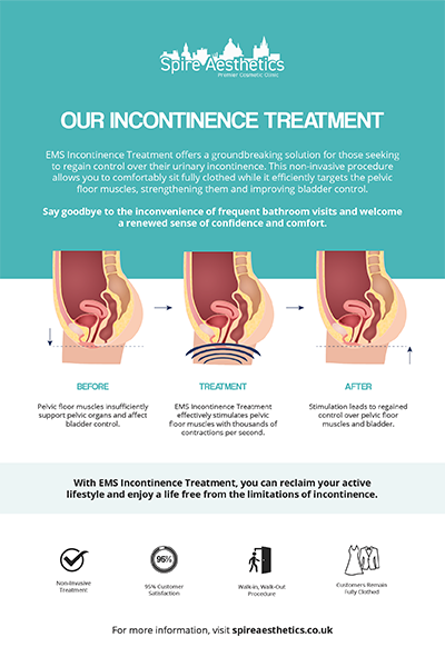 image of how urge incontinence Barry treatment works