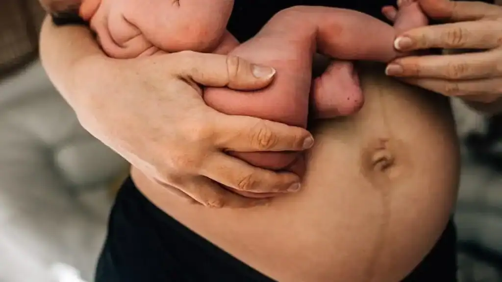 Why Is My Stomach Still Big After Pregnancy Barry?